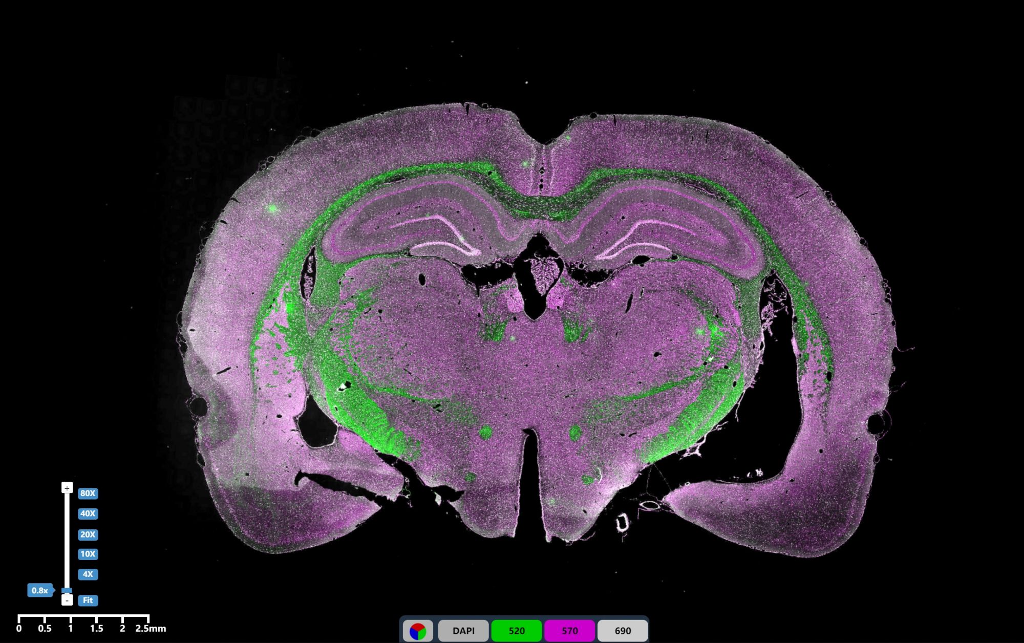 免疫熒光三標腦組織