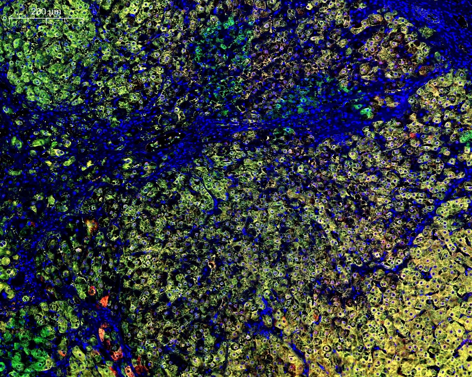 mIHC的檢測(cè)案例