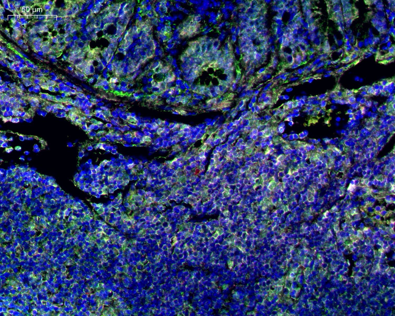 mIHC的檢測(cè)案例